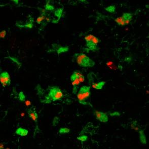 microglial cells (green) are engulfing and eliminating prion-damaged photoreceptors (red), which appears to slow retinal degeneration