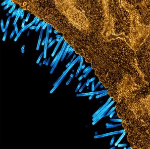 swine influenza virus particles attached to and budding off a cell