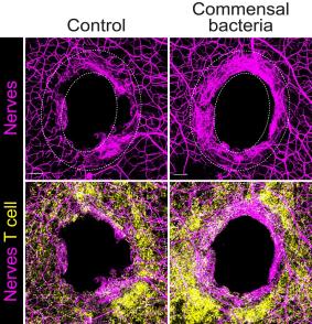 This confocal microscope image shows a ring of nerve regeneration occurring in mice (bottom right). Scientists exposed the mice to commensal bacteria (Staphylococcus aureus), then a month later the mice sustained an ear injury (biopsy). Ten days later the scientists took the image to document the nerve fiber recovery progress associated with immune cell responses (gold staining).