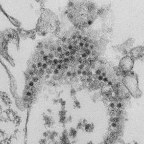 Enterovirus-D68 (EV-D68) virions