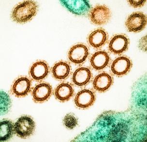 Image of influenza virus particles