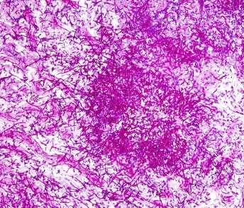 photo of candida albicans