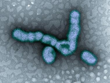 Transmission electron micrograph of H1N1 virus particles.