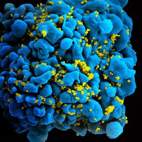 HIV-infected T cell