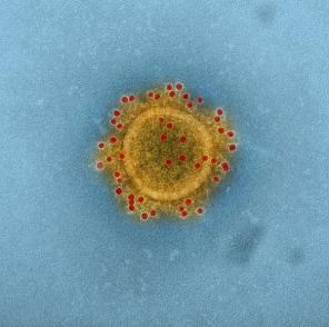 MERS Coronavirus Particle