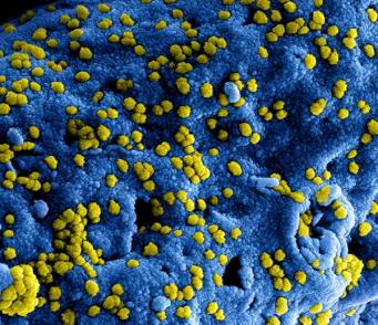 MERS virus particles attached to the surface of an infected cell.