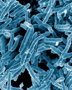Scanning electron micrograph of Mycobacterium tuberculosis bacteria which cause tuberculosis