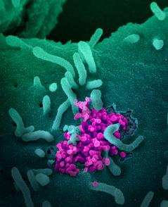 This scanning electron microscope image shows SARS-CoV-2 (round magenta objects) emerging from the surface of cells cultured in the lab. SARS-CoV-2, also known as 2019-nCoV, is the virus that causes COVID-19. The virus shown was isolated from a patient in the U.S. 