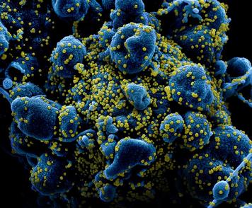 Photo of SARS-COV-2 virus particles