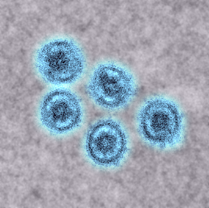 This colorized transmission electron micrograph shows a slice of Reston virus particles (blue) in the lung of an infected pig.
