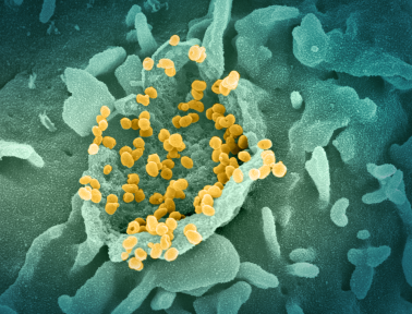 A scanning electron microscope image showing SARS-CoV-2 virus particles (which appear as spheres) emerging from the surface of a cell cultured in the lab.