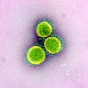 Transmission electron micrograph of SARS-CoV-2 virus particles