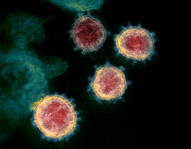 SARS-CoV-2 virus particles are shown emerging from the surface of cells cultured in the lab.