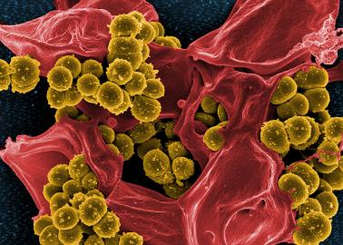 Micrograph of MRSA