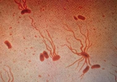 S. Typhi shown under a microscope