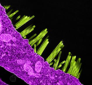 A picture of swine flu virus particles budding from the surface of a cell.