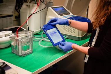 Researcher checks western/moisture blots to know if proteins bind to antibodies