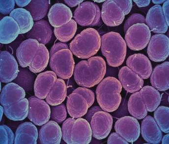 This scanning electron micrograph shows Neisseria gonorrhoeae bacteria, which can cause gonorrhea.