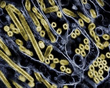 该图像显示了在蓝色 Madin-Darby 犬肾上皮细胞中生长的金色禽流感 H5N1 病毒颗粒的彩色图像。