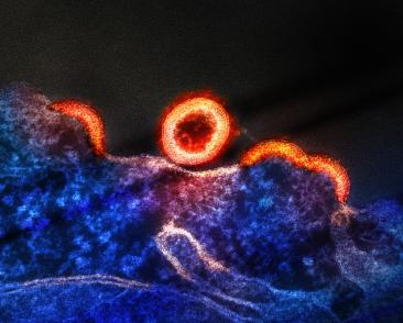 One orange, spherical immature virus particle is shown at the center of the image near the blue and purple H9 T-cell.
