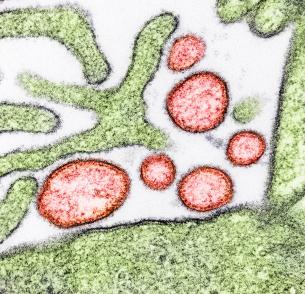 Colorized transmission electron micrograph of mature extracellular Nipah Virus particles (red) near the periphery of an infected VERO cell (green).