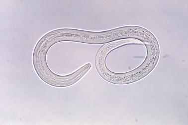 two loops show micrograph of parasitic worm larva