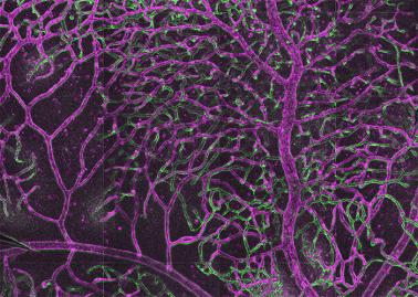Image of vascular branches in the retina
