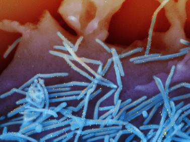 Scanning electron micrograph of human respiratory syncytial virus (RSV) virions.