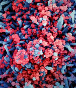 Colorized scanning electron micrograph of a cell (blue) heavily infected with SARS-CoV-2 virus particles (red), isolated from a patient sample.