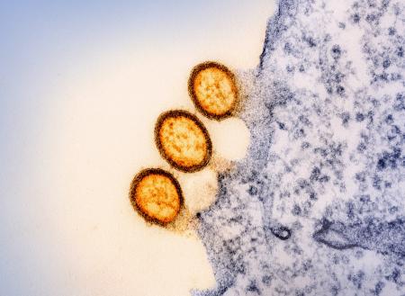 Three light orange ovals with blue and purple speckled matter across half of the image surface.