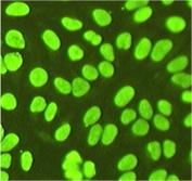Nuclear staining with FcγRII -/- Nucleolar staining in FcγRII -/- Yaa no staining in WT