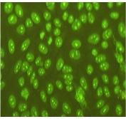 Nuclear staining with FcγRII -/- Nucleolar staining in FcγRII -/- Yaa no staining in WT