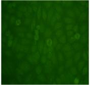 Nuclear staining with FcγRII -/- Nucleolar staining in FcγRII -/- Yaa no staining in WT