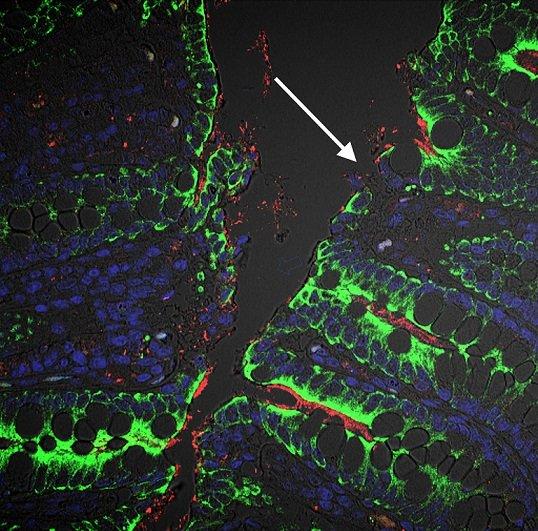 Confocal microscopy of cytokeratin (green) and E coli (red) in the colon of a chronically SIV-infected rhesus.