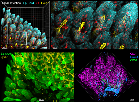 3D reconstruction of small intestine (CAT-I)