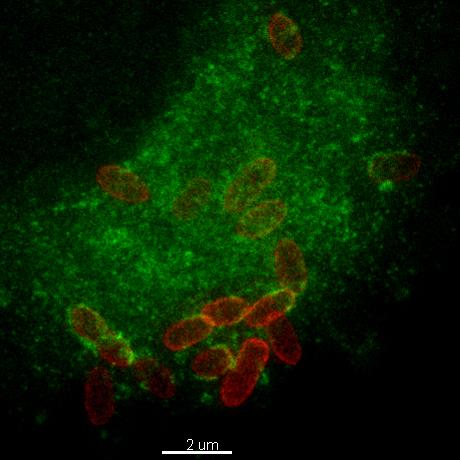 Stimulated emission depletion (STED) microscopy was used to explore intracellular trafficking of in Granulibacter bethesdensis (Cy5-labeled, red) as it localized to vacuoles containing Lysosomal-Associated Membrane Proten-1 (LAMP-1, green) in human monocy