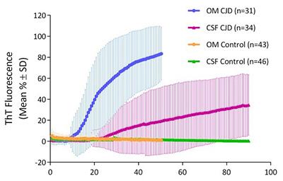 RT-QuIC comparison of nasal brushings (OM) and cerebrospinal fluid (CSF) specimens from human Creutzfeldt-Jakob disease (CJD) vs non-CJD control patients.