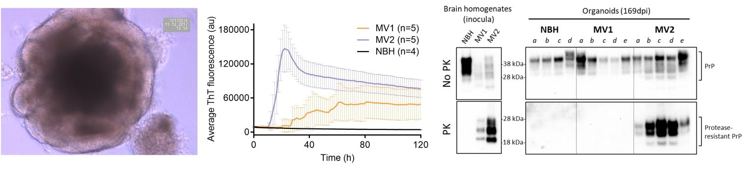 Three side-by-side photos of 1. a young human cerebral organoid, 2. a prion seeding assay of organoids, and 3. western blotting for protease-resistant prion protein