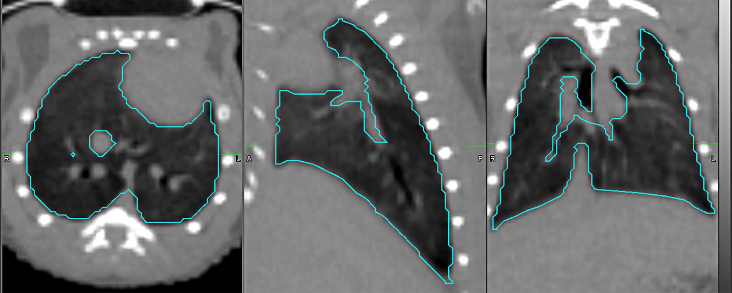 Image of lung segments.
