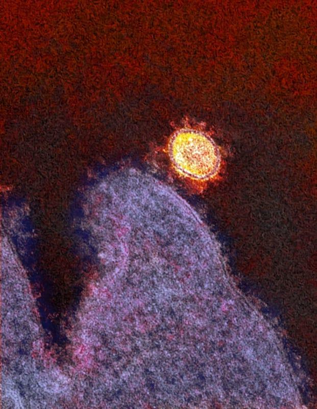 Image of SARS-CoV-2 in Rhesus Macaque