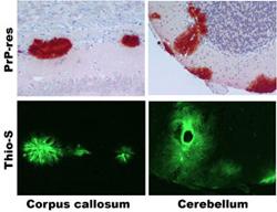 Protease-resistant prion protein (PrP-res)