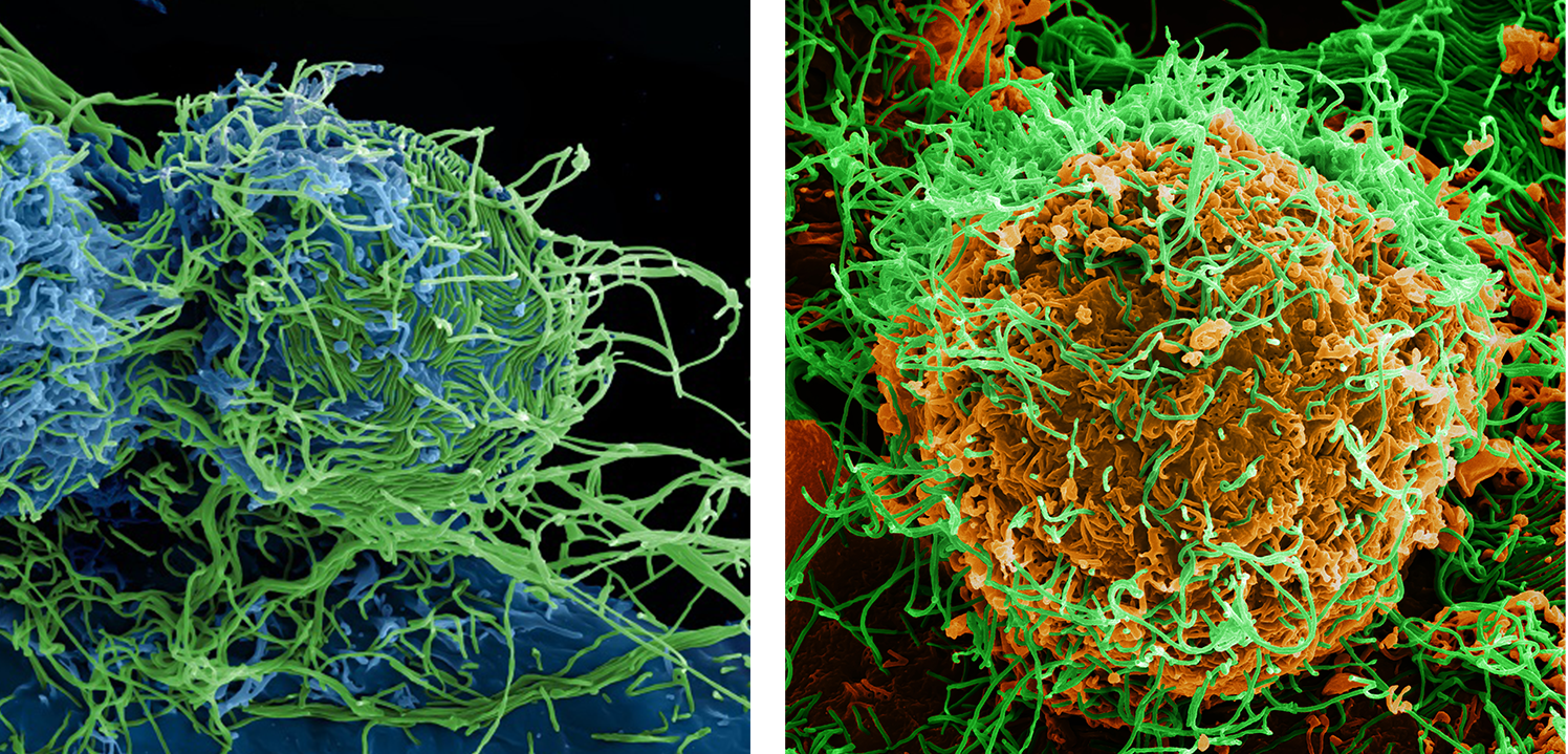 cells infected with ebola virus