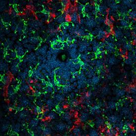 Immunofluorescent image of immune cells surrounding a hair follicle