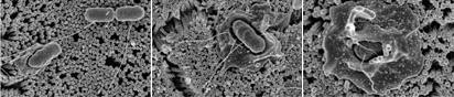 Scanning electron micrographs showing S. Typhimurium invading human intestinal epithelial cells (C2Bbe1).