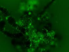Langat virus infection (bright green) in the tick midgut (black) is shown at six days after infection in this fluorescence image