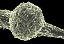 Ebola virus Makona covering the surface of an infected cell.