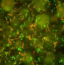 Spiral-shaped Borrelia burgdorferi bacteria appear to glow red and green