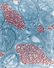 Colorized electron microscope image of mosquito salivary gland tissue infected by the eastern equine encephalitis virus