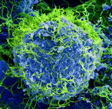 Ebola virus particles both budding and attached to the surface of infected VERO E6 cells