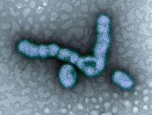 Transmission electron micrograph of H1N1 virus particles.